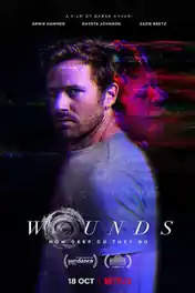 Wounds 2019 BluRay 300Mb Hindi Dual Audio ORG 480p ESub poster | Bolly4u Official